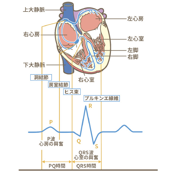 心電図検査のイメージ図