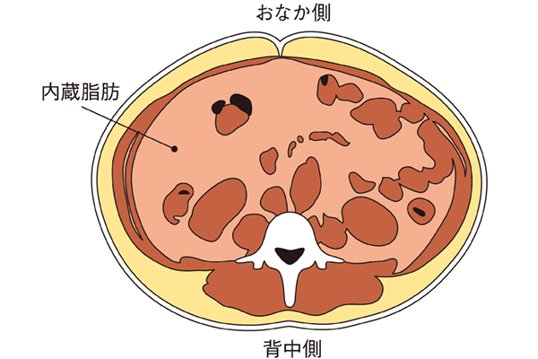 肥満の内臓脂肪イメージ図